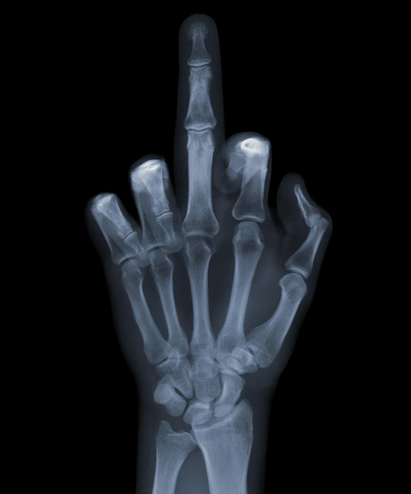 middle finger x ray The X Ray Vision of Nick Veasey