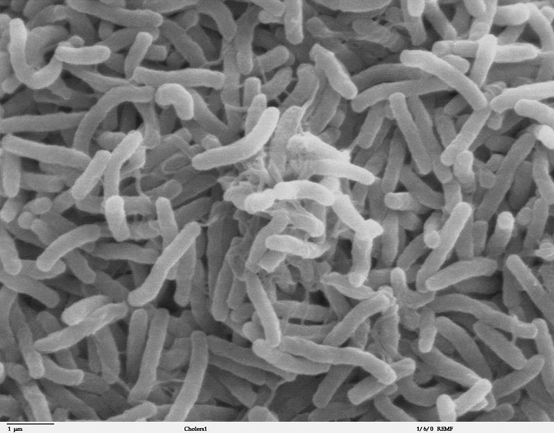 cholera culture of bacteria 10 Bizarre Names for a Group of Animals