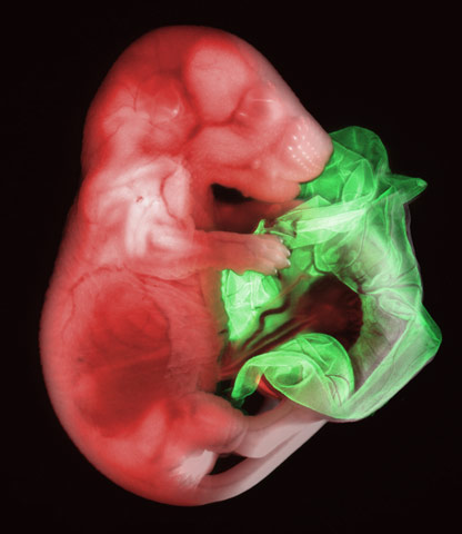 gloria kwon double transgenic mouse embryo 185 days 17x Winners (07 10) from Nikons Small World Competition [20 pics]