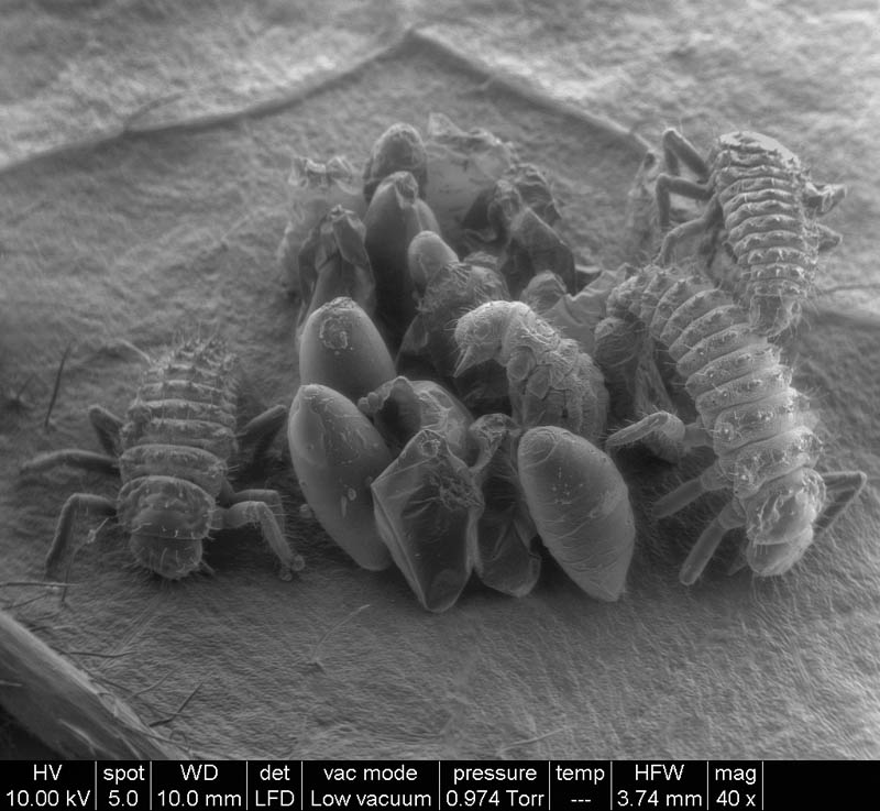 birth of ladybugs macro microscope photograph riccardo antonelli Incredible Examples of Electron Microscope Photography