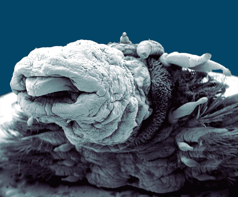 hydrothermal worm macro philippe craqssous Incredible Examples of Electron Microscope Photography