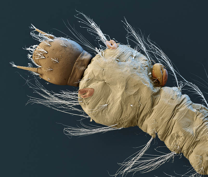 mosquito larva with parasite electron microsope image nicole ottawa Incredible Examples of Electron Microscope Photography