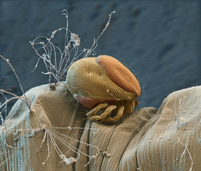 parasitic mite on mosquito larva nicoe ottawa Incredible Examples of Electron Microscope Photography