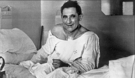 lewis washkansky first heart transplant This Day In History   December 21st