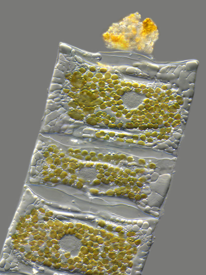 2011 9 bettighofer diatom 20 Award Winning Microscope Images