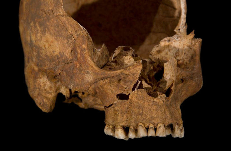 ing richard III skeleton bones body found university of leicester (1)