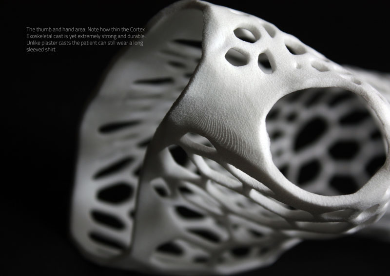 3D printed cast design by jake evill (4)