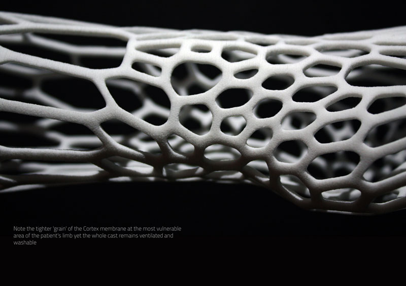 3D printed cast design by jake evill (5)