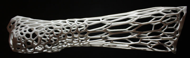 3D-printed-cast-design-by-jake-evill-(8)