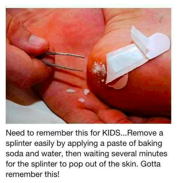 how to remove a spliinter with baking soda and water life hack 40 Clever Life Hacks to Simplify your World