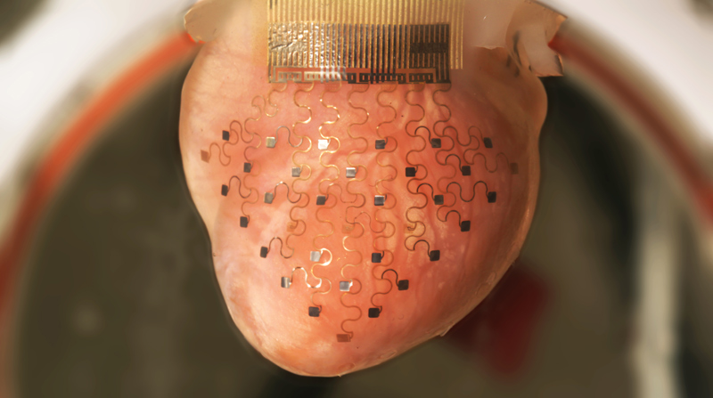 revolutionary membrane keeps heart beating outside of the body (1)