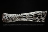 Could This Be the 3D-Printed Cast of the Future?