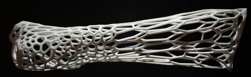 Could This Be the 3D-Printed Cast of the Future? - TwistedSifter