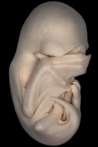 2013 2 hockman bat embryo 2013  2 Hockman bat embryo