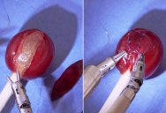 Doctor Uses Robot to Stitch a Grape Back Together