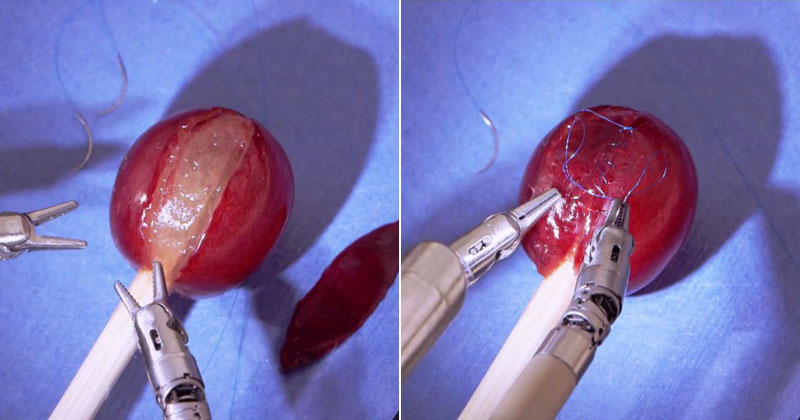 Doctor Uses Robot to Stitch a Grape Back Together
