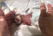 World’s Smallest Boy (Born 268g/9.45oz) Gets Discharged From Hospital