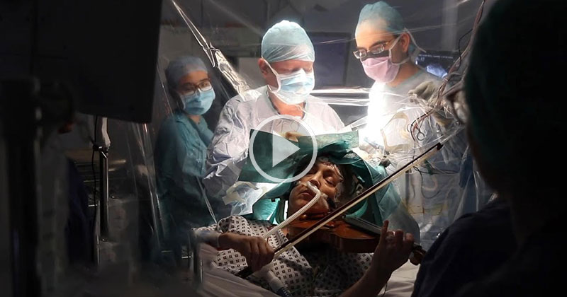 Doctors Tell Musician to Play Violin During Brain Surgery So She Won’t Forget