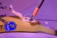 Doctor in London Performs Remote Surgery on Banana in California
