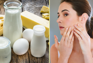 The Truth About Whether Or Not Milk Causes Acne