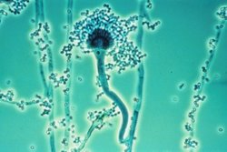 Aspergillus WHO Releases A List Of The Worlds Most Dangerous Fungi