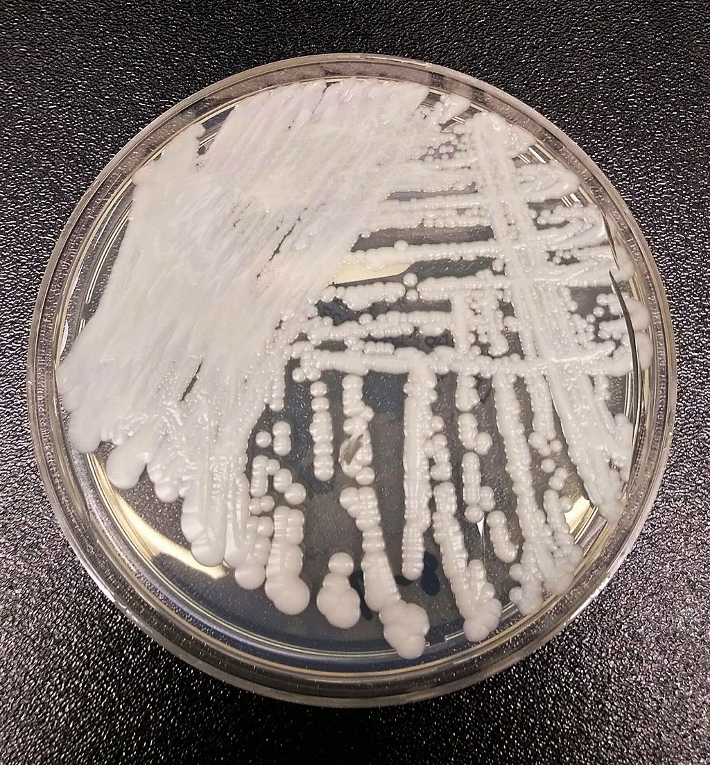 Candida auris 2016 250px 1 WHO Releases A List Of The Worlds Most Dangerous Fungi