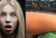 Scientists Can’t Figure Out Why Some People Can Control When They Get Goosebumps