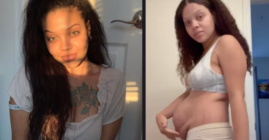 A Mom Shared Her Postpartum Body and Called Out Society’s Ridiculous Expectations