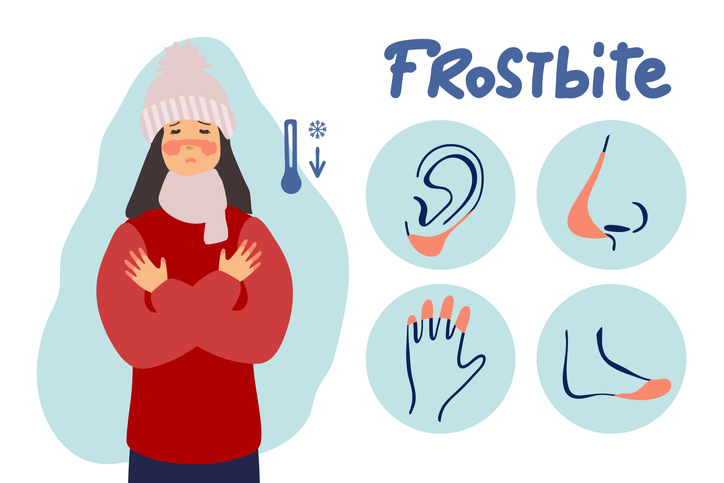 iStock 1294398389 Knowing The Differences Between Chilblains And Frostbite Could Save Your Fingers
