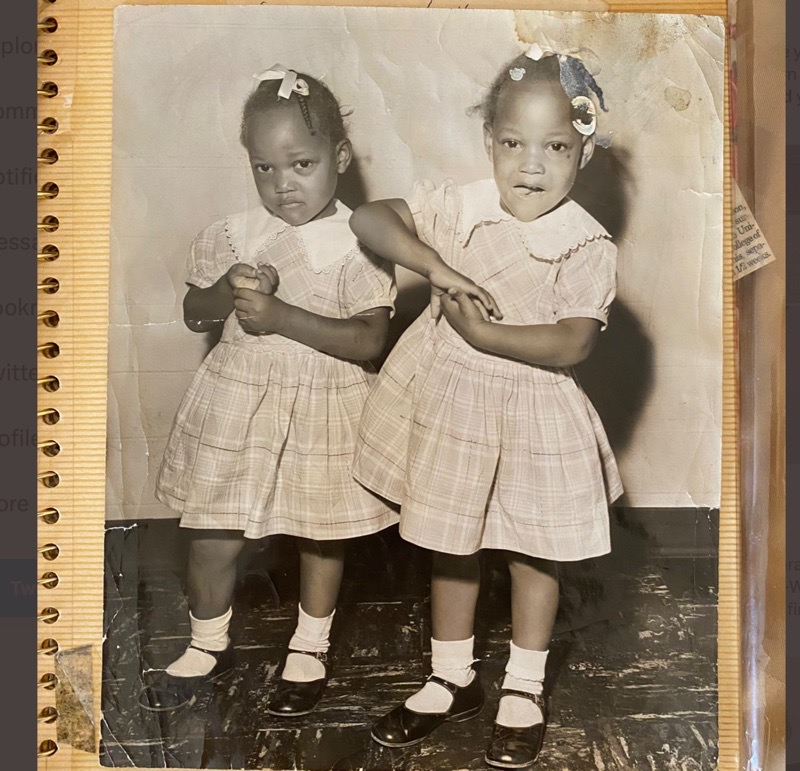 MatthewstwinsA res 1 Separated in 1955, Conjoined Twins Talk About Life After Surgery