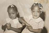 Separated in 1955, Conjoined Twins Talk About Life After Surgery