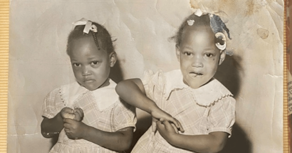 Separated in 1955, Conjoined Twins Talk About Life After Surgery