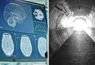 Doctors Witness Brain Activity In Coma Patients As Life Support Is Ended