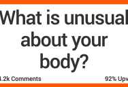 What’s Unusual About Your Body? Here’s What People Said.