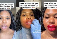 A Woman’s Lip Treatment Fail Went Viral And We Definitely Feel For Her