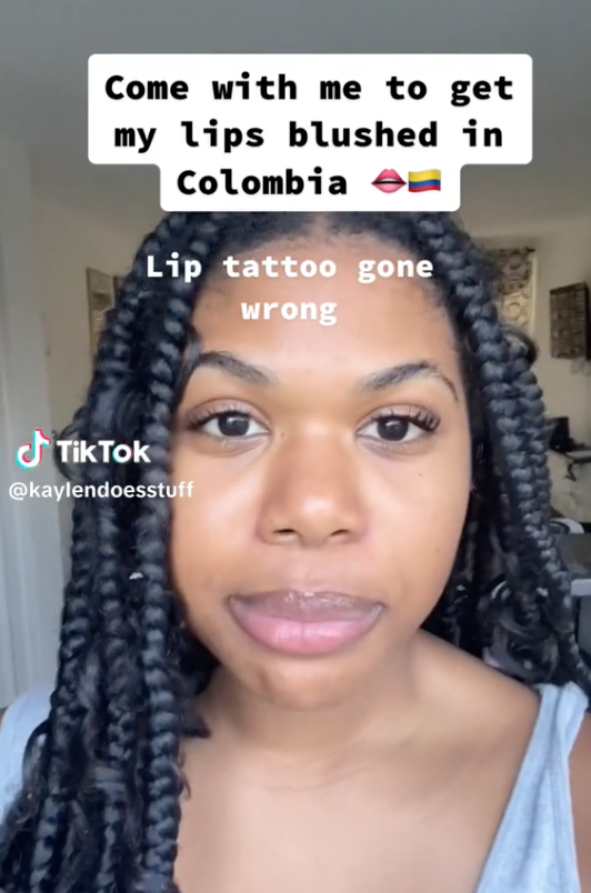 Screen Shot 2023 06 06 at 9.04.18 AM A Woman’s Lip Treatment Fail Went Viral And We Definitely Feel For Her