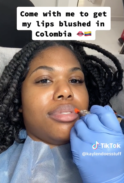 Screen Shot 2023 06 06 at 9.04.33 AM A Woman’s Lip Treatment Fail Went Viral And We Definitely Feel For Her