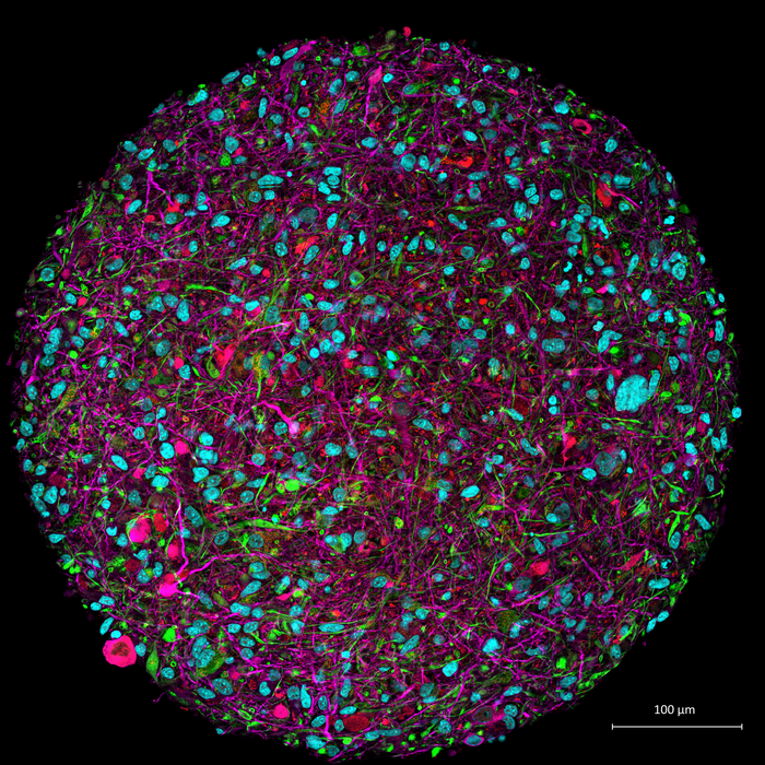 Low Res Brain organoid credit Thomas Hartung Johns Hopkins University.jpg Scientists Are Building Organoid Intelligence Biocomputers Using Brains Grown In A Lab To Rival Artificial Intelligence