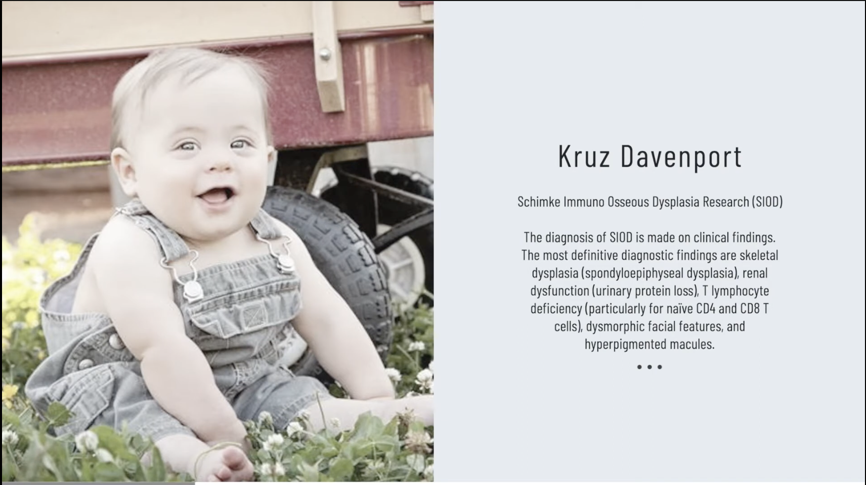 Screen Shot 2023 07 18 at 11.13.38 AM Parents Raise $3M To Save Children With Fatal Form Of Dwarfism