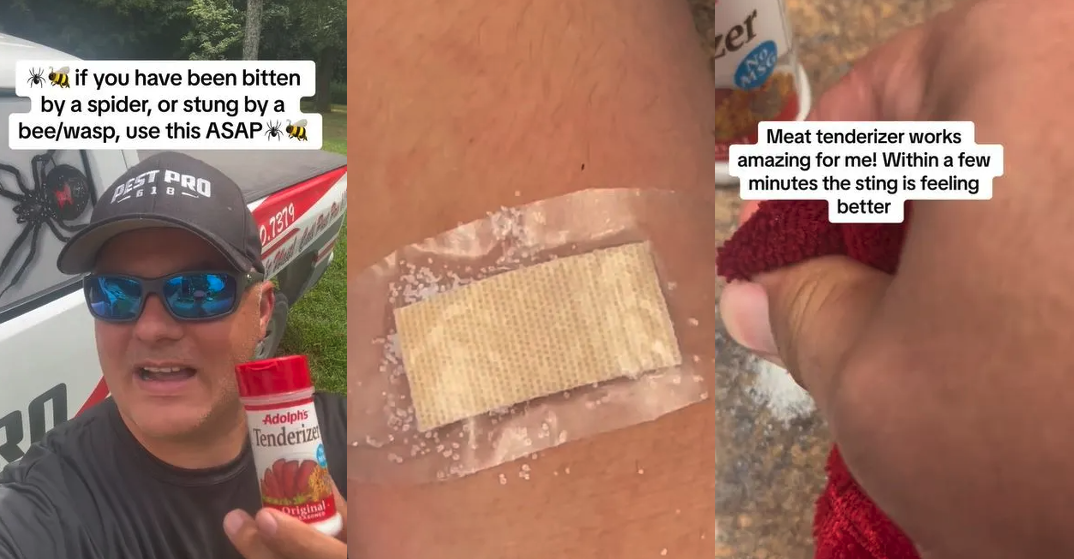 ‘This is what I keep in my first aid kit.’ TikToker Shows How Meat