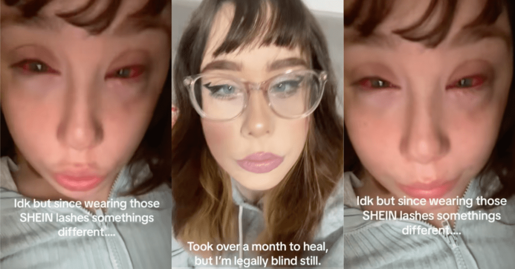 'Took over a month to heal.' A Woman Said That “Contaminated” Lashes Blinded Her And She's Still Suffering From Vision Loss