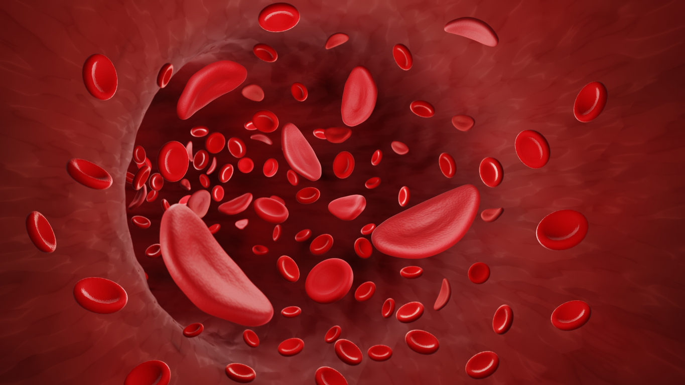 iStock 1333139316 How A Five Year Old Was Cured Of Sickle Cell Anemia.   Definitely saved his life.