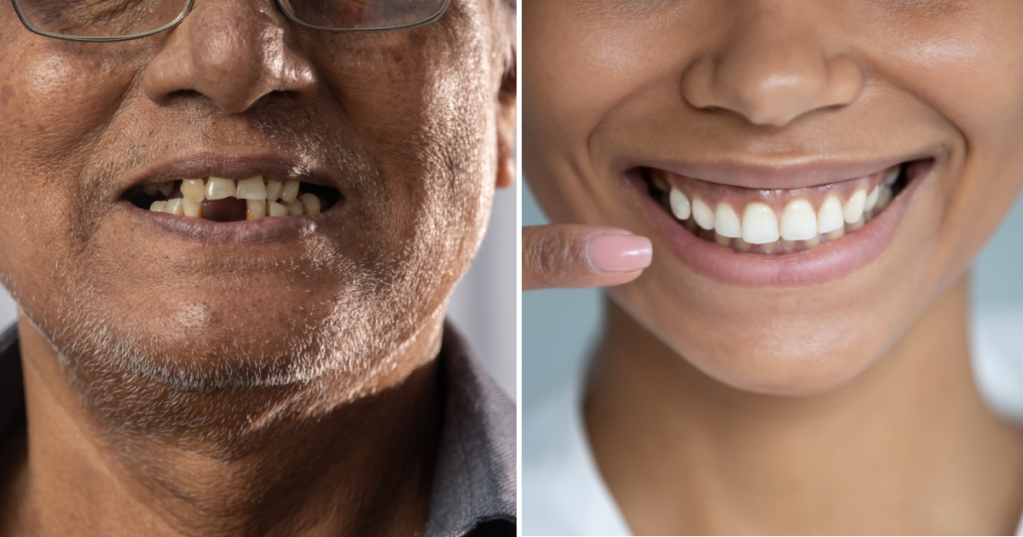 Japanese Scientists Are Developing A Process To Regrow Human Teeth