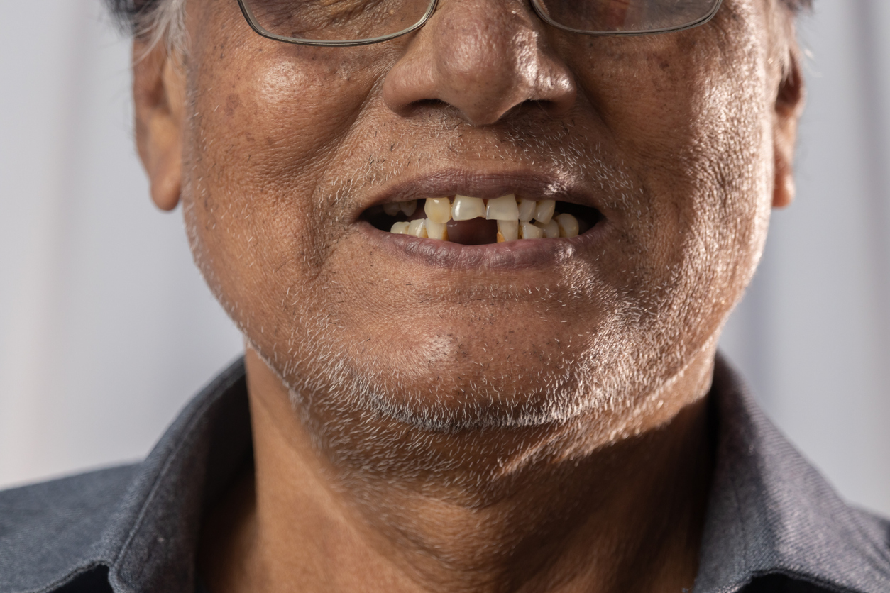 iStock 1396776313 Japanese Scientists Are Developing A Process To Regrow Human Teeth