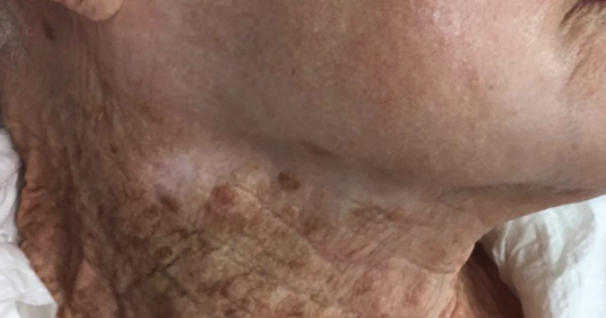 Here Are The Effects That Sunscreen Can Have On The Appearance Of Your