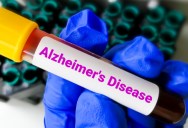 New Theory Could Be A Turning Point For Alzheimer’s Research