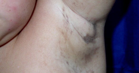 Source: Journal of Medical Case Reports 2009