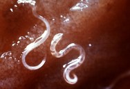 Doctors Are Considering Hookworms As A Treatment For Ulcerative Colitis