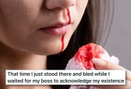 Employee Gets An Unexpected Nose Bleed, So They Asked To Leave A Meeting. Their Boss Told Them Not To Be Rude And Interrupt.