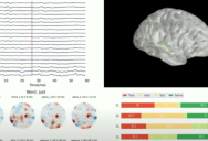 New AI Powered Device Displays Impressive Mind Reading Capabilities